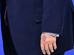 Bluterguss wegen "Friedensrat" : Weißes Haus nennt ungewöhnlichen Grund für Trumps blaue Hand